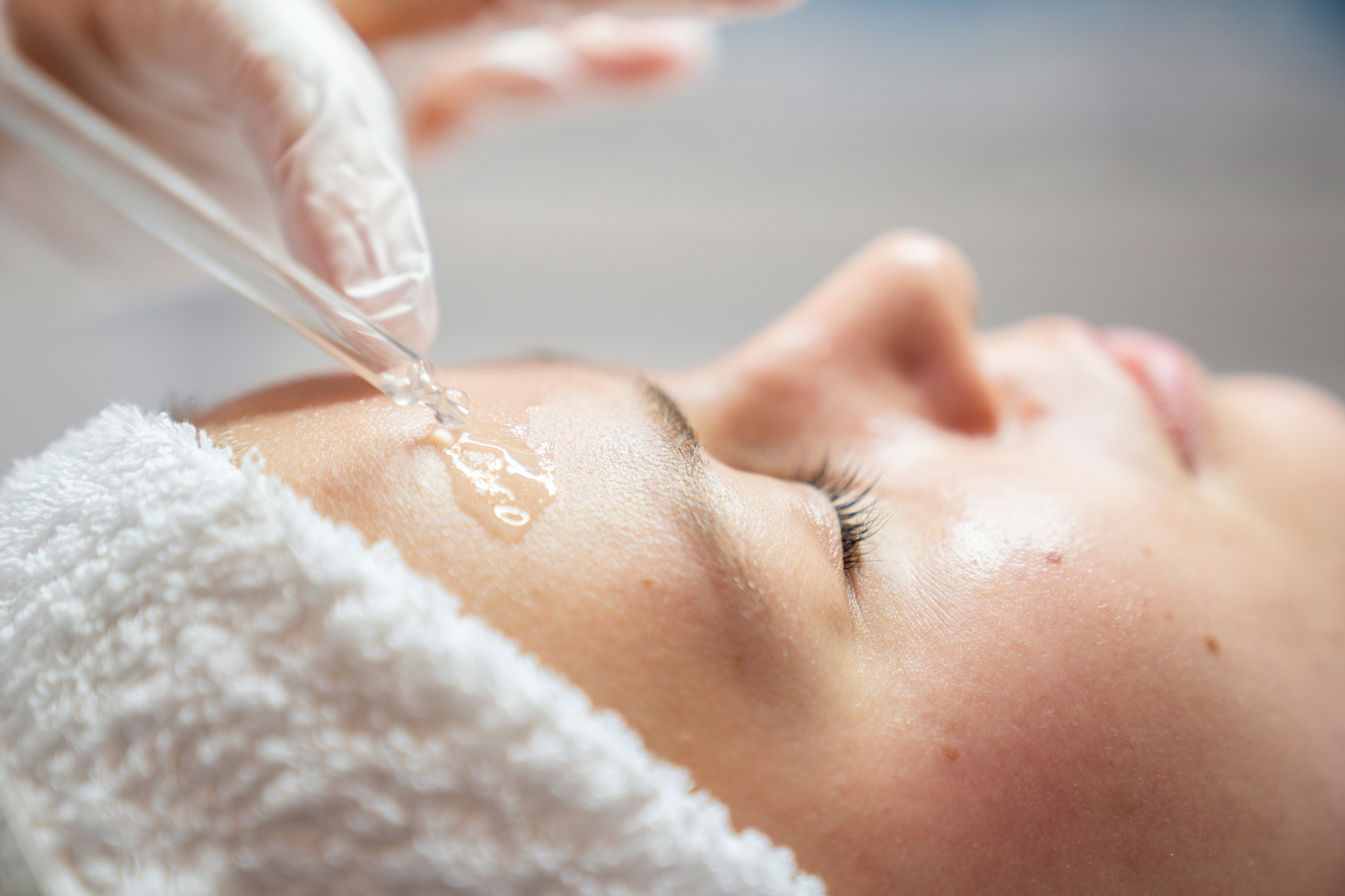 The PreWedding Facial That Saved My Acne Prone Skin The Wedding Edition